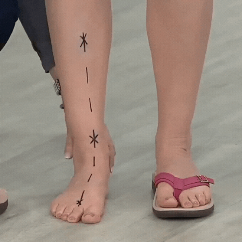 Kerry | Sandalias ortopédicas de verano